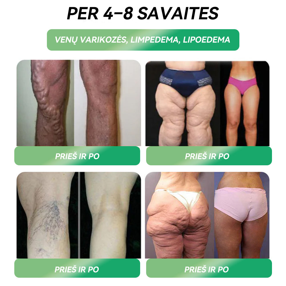 Santaros universiteto sveikatos centro rekomendacijos | Oficiali parduotuvė| 𝑆𝑇𝐷𝐸𝐼®🐮 𝐺𝐿𝑃-1 𝑆𝑣𝑜𝑟𝑖𝑜 𝑛𝑒𝑡𝑒𝑘𝑖𝑚𝑎𝑠 Ž𝑜𝑑𝑖𝑛𝑖𝑠 𝑠𝑝𝑟𝑒𝑛𝑑𝑖𝑚𝑎𝑠 - 👨⚕️Nutukimas, širdies ir kraujagyslių ligos, diabetas, miego apnėja, sąnarių problemos ir daugiau